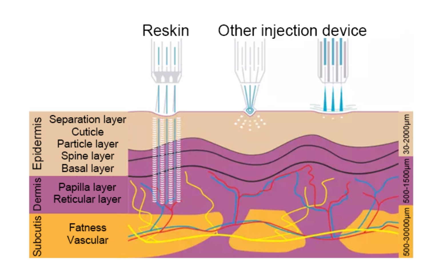 ejektor